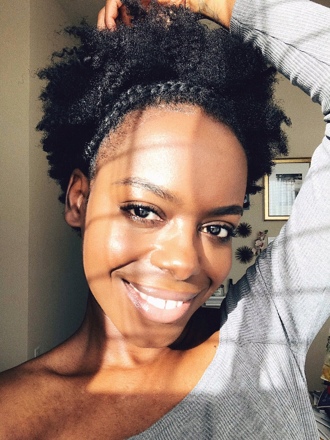 My One Year Fibroid Surgery Anniversary